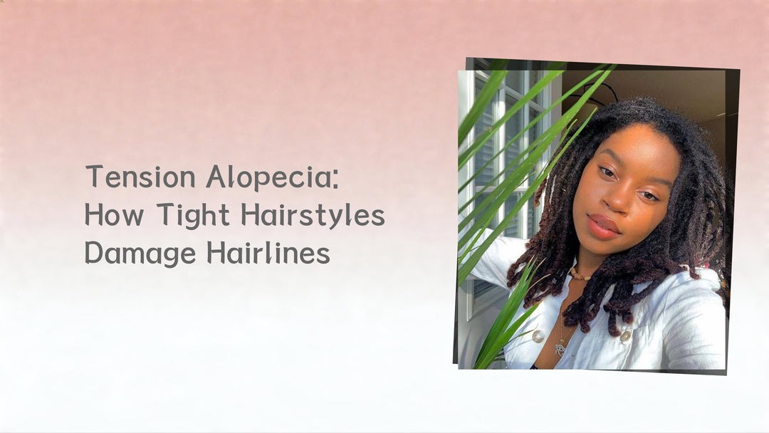 Tension Alopecia: How Tight Hairstyles Damage Hairlines