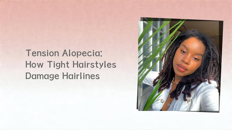 Tension Alopecia: How Tight Hairstyles Damage Hairlines